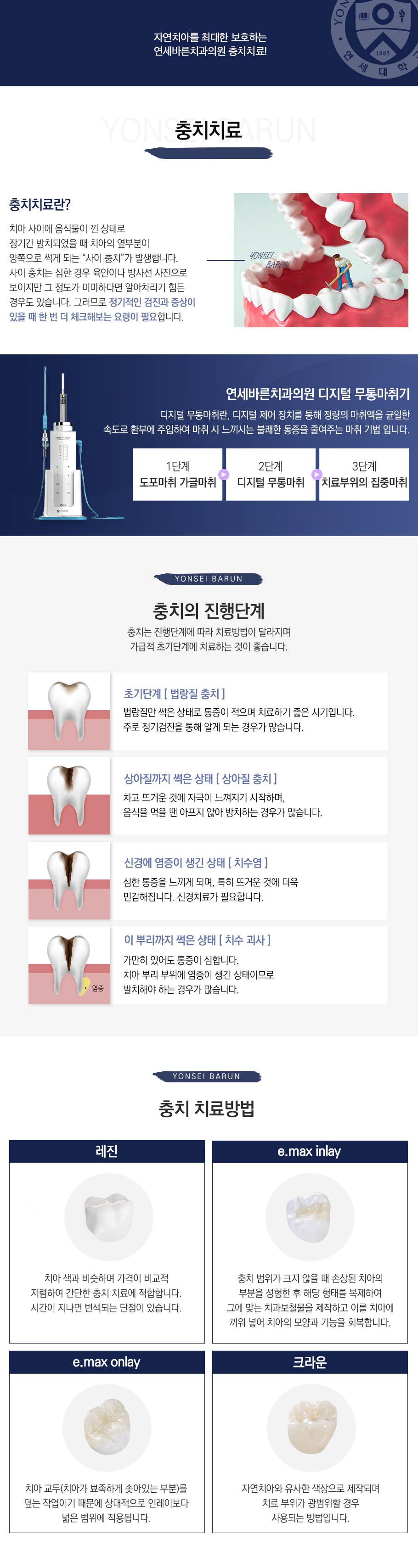 충치치료