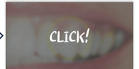 치료 후