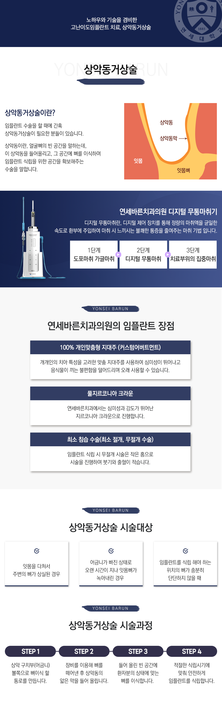 상악동거상술