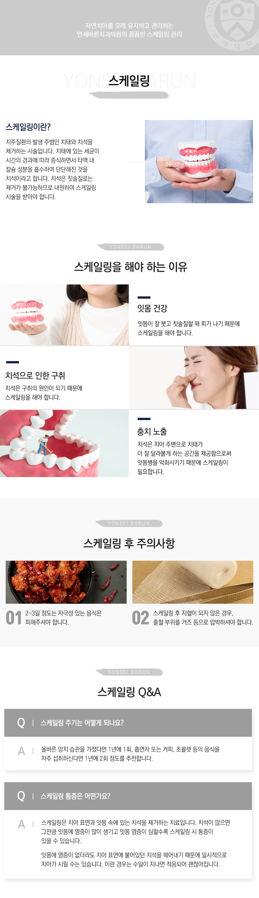 스케일링