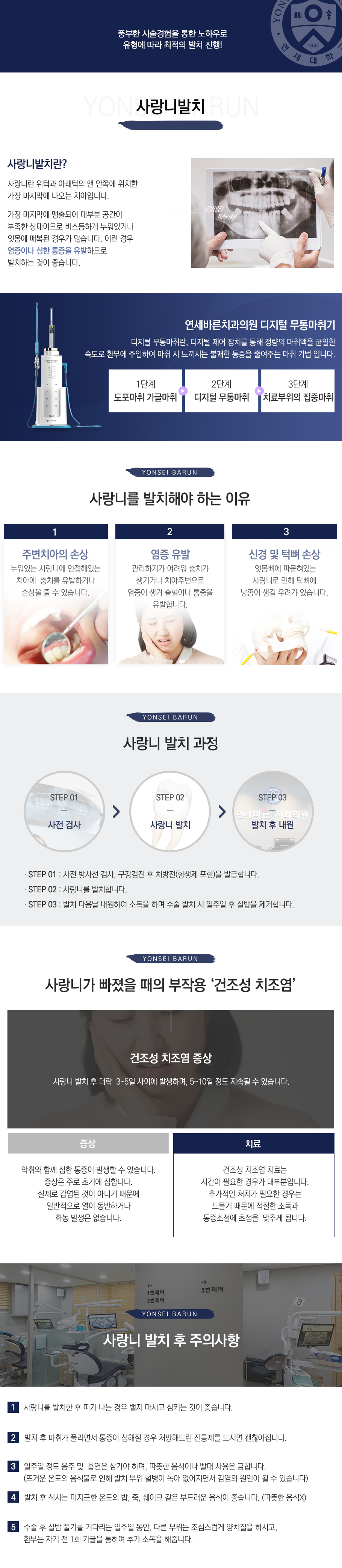사랑니 발치